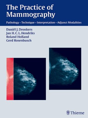 cover image of The Practice of Mammography